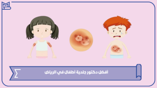 أفضل دكتور جلدية أطفال في الرياض